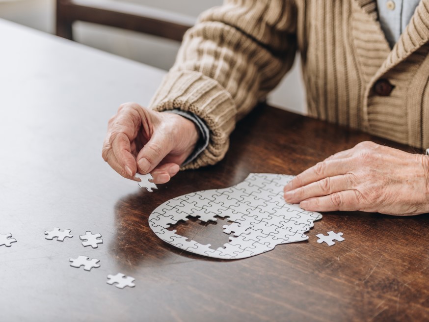 hospital de santa maria porto Doenca de Alzheimer–um alerta para a prevencao2